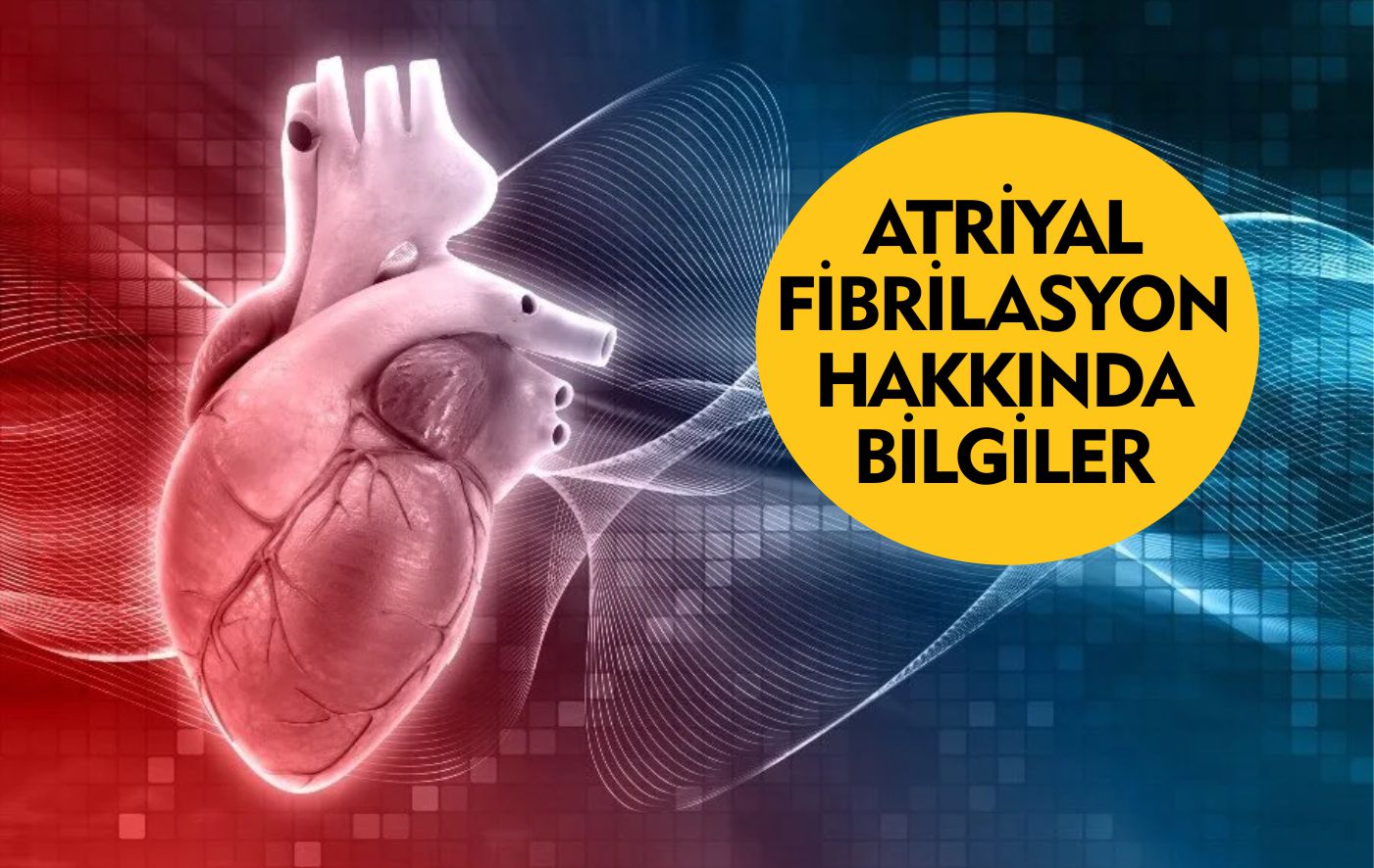 ATRİYAL FİBRİLASYON