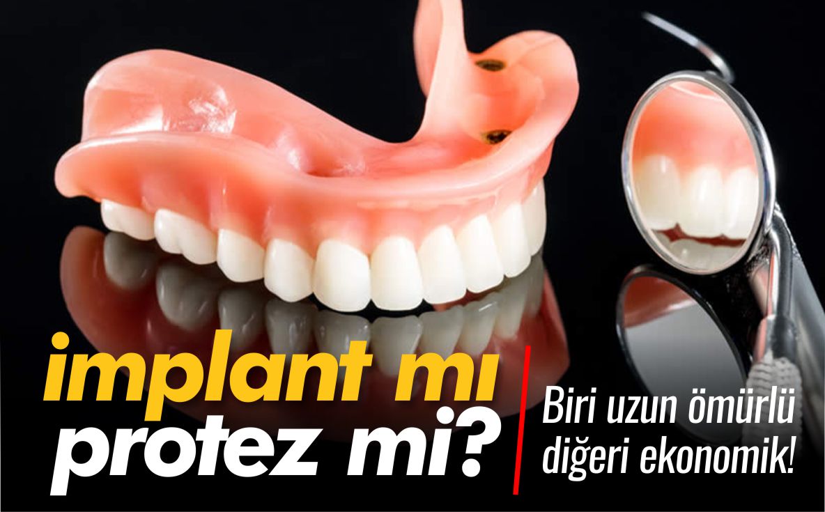 implant-mı-protez-mi