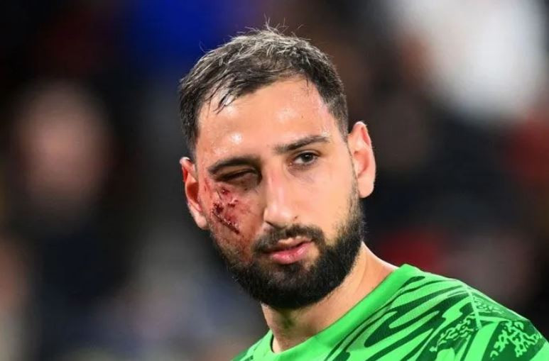 Hakemden skandal karar! Bu pozisyona kart çıkmadı! İtalyan kaleci Donnarumma'nın yüzüne dikiş atıldı!