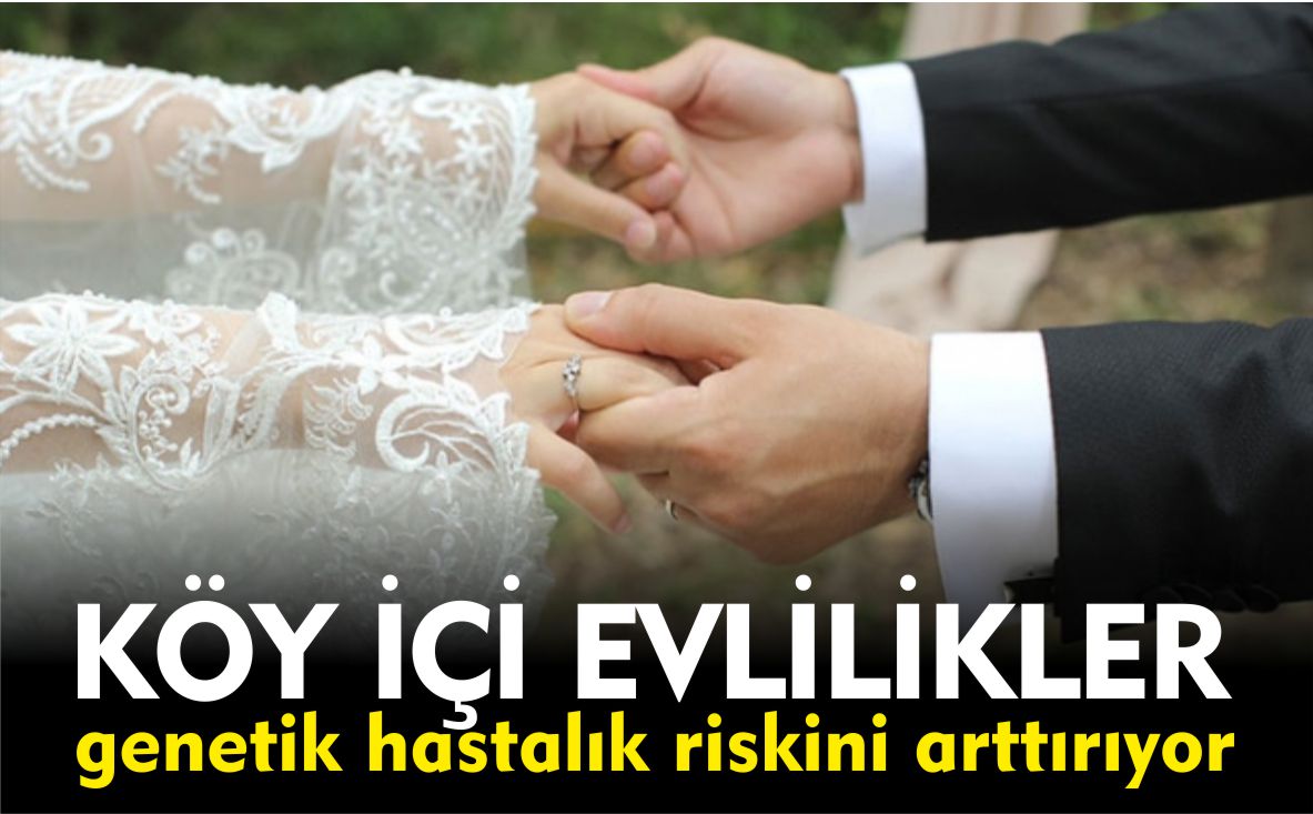 köy-içi-evlilik-genetik-hastalık-niski